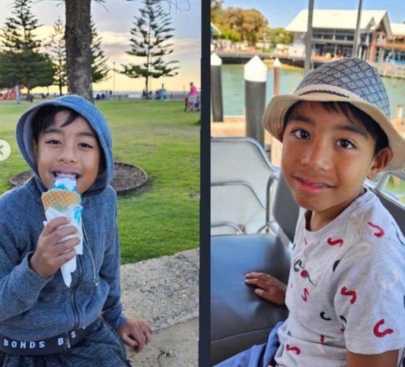 The same child smiling outdoors after treatment